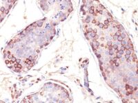 Formalin-fixed, paraffin embedded human testis sections stained with 100 ul anti-MAGE-1 (clone SPM282) at 1:100. HIER epitope retrieval prior to staining was performed in 10mM Citrate, pH 6.0.